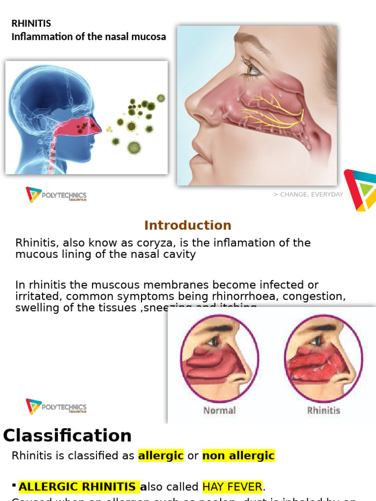 Understanding Rhinitis: Types & Treatment | PDF | Allergy | Allergen