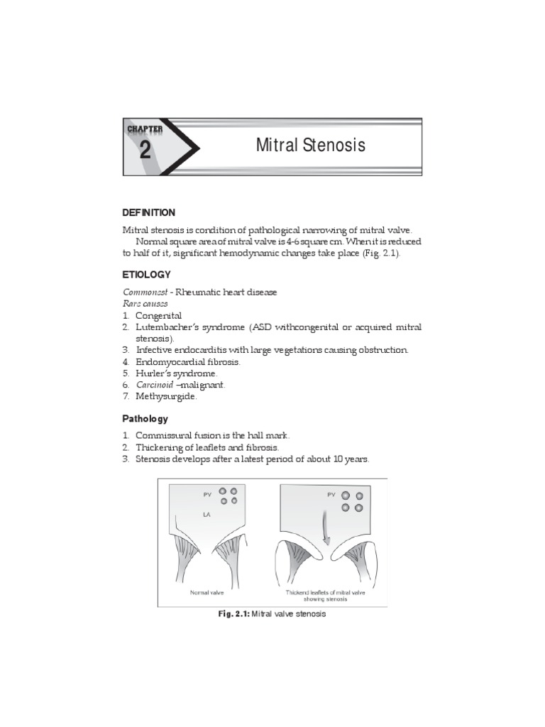 Mitral Stenosis | PDF | Heart | Heart Valve