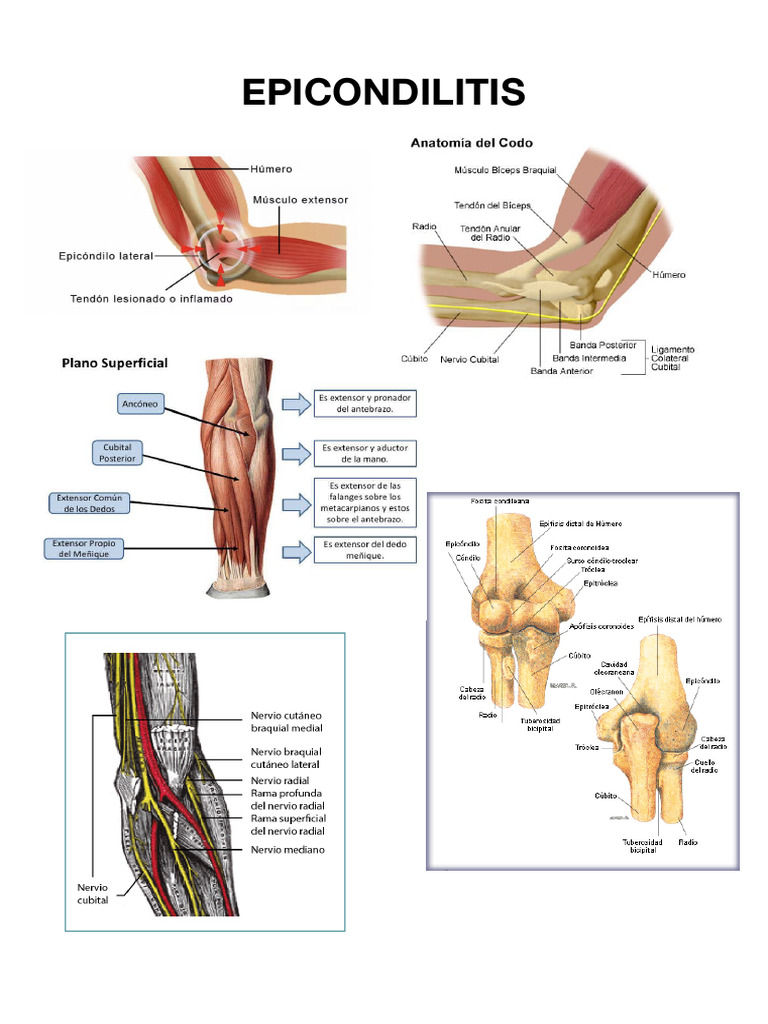 EPICONDILITIS | PDF | Enfermedades y trastornos | Especialidades Medicas