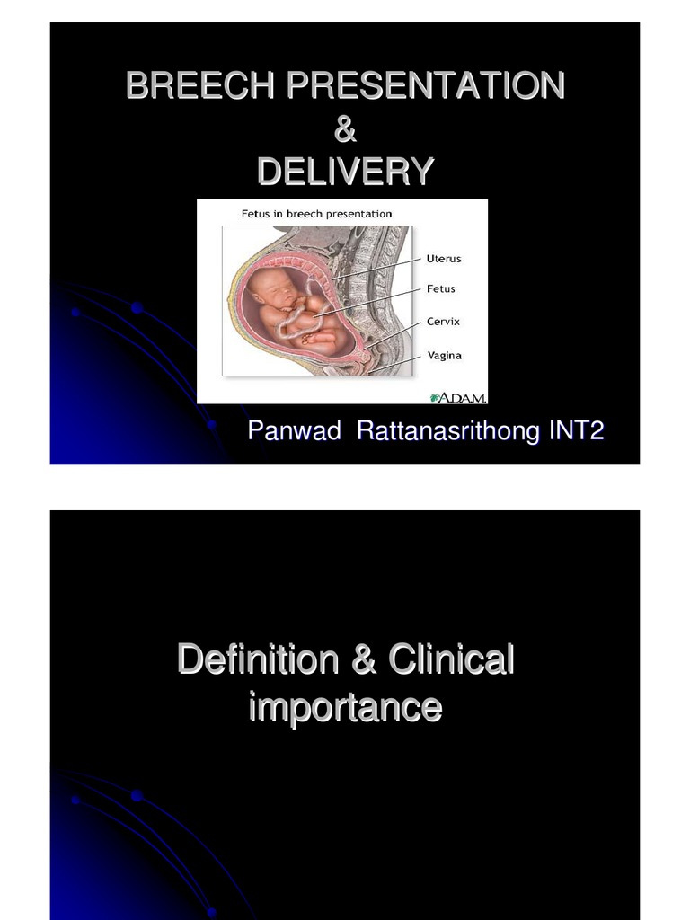what is maternal care for breech presentation