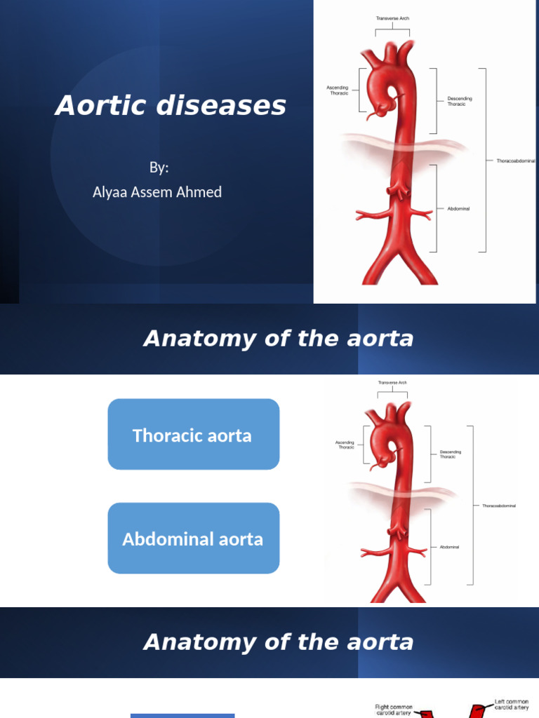 Comprehensive Guide to Aortic Diseases | PDF | Aorta | Common Carotid ...