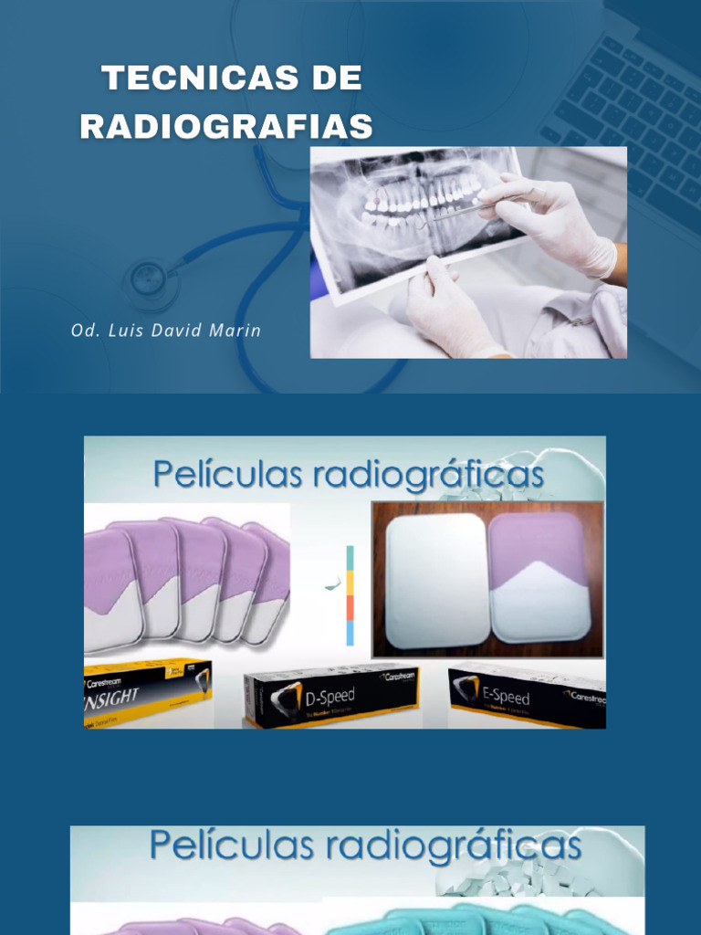 Placa De Imagen De Fósforo Dental #0 Y #2 | Cuotas sin interés