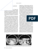 COMPLICACIONES DE PERFORACIÓN ESPONTÁNEA DE COLON