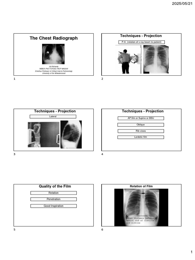Chest X Ray | PDF | Lung | Aorta