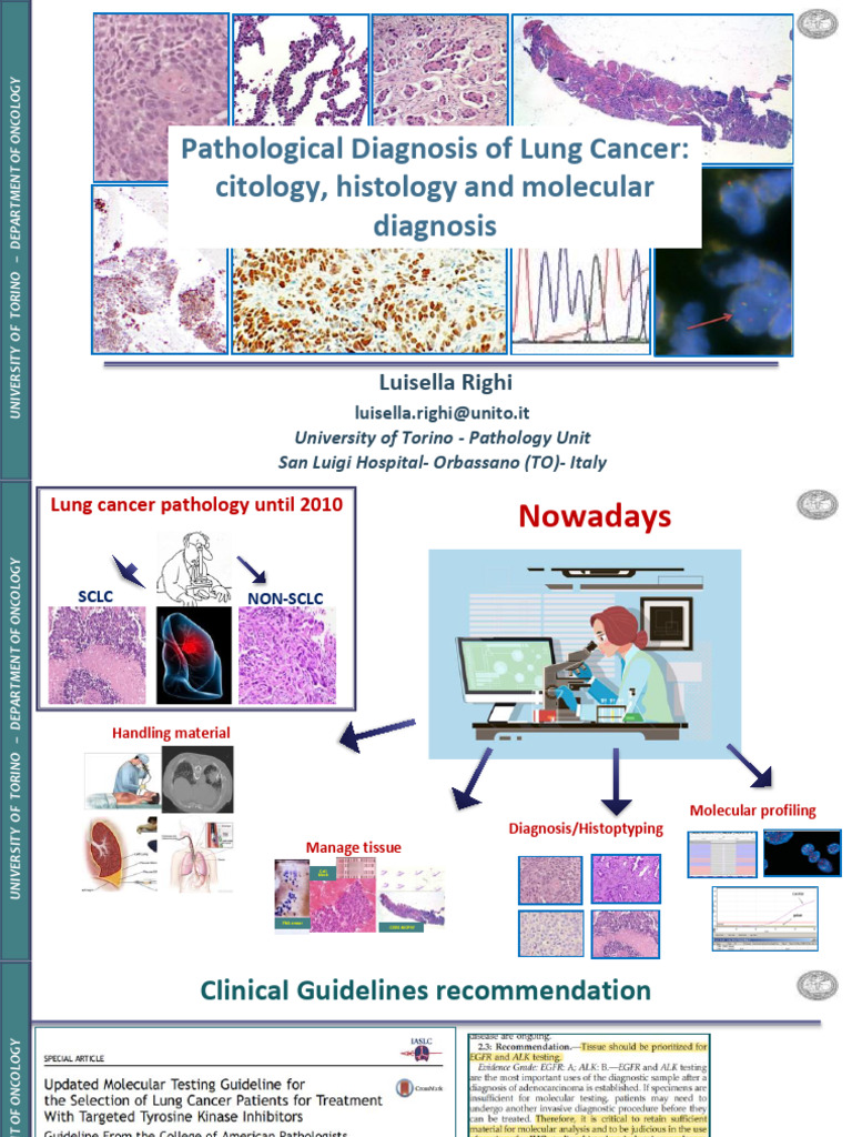 Lung Cancer Pathology and Diagnosis Guide | PDF | Biopsy | Epidermal ...