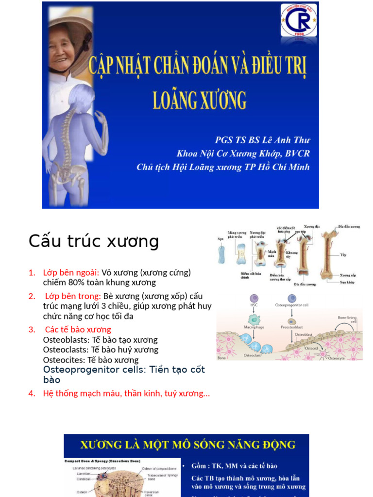 Loãng Xương | PDF