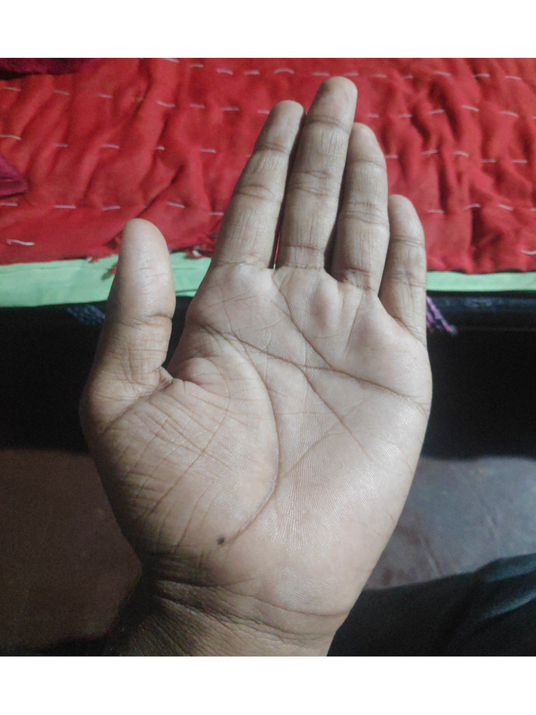 Hand | PDF