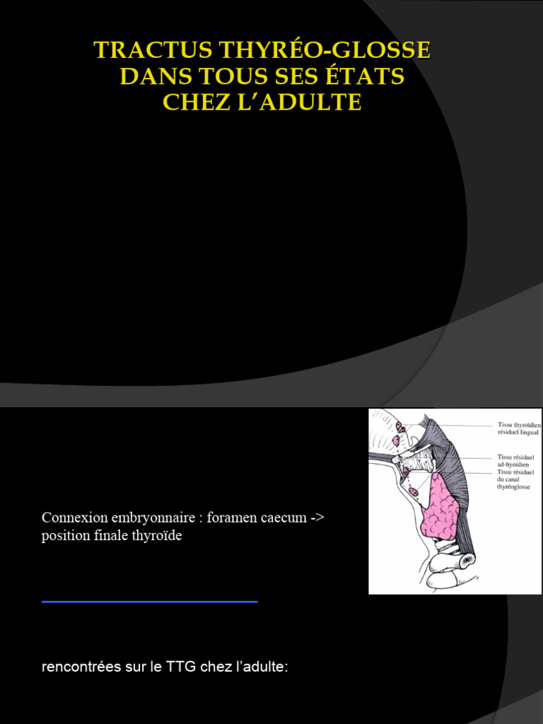 Kystes et Ectopies du Tractus Thyroïdien | PDF | Thyroïde | Anatomie ...