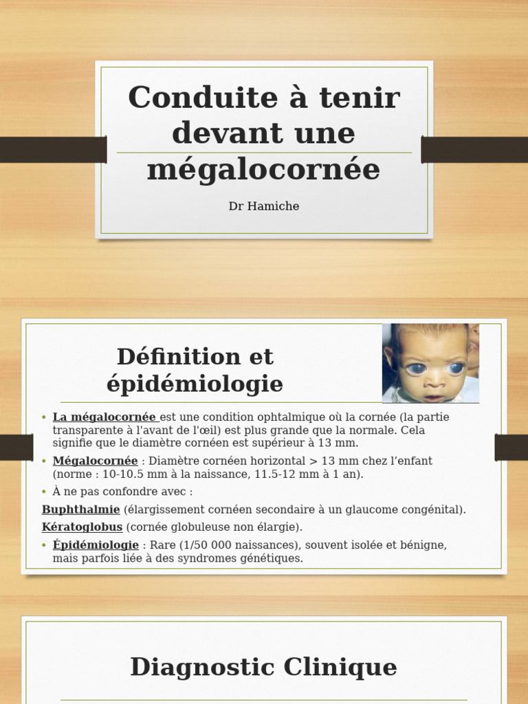 Conduite à tenir pour la mégalocornée | PDF | Glaucome | Ophtalmologie