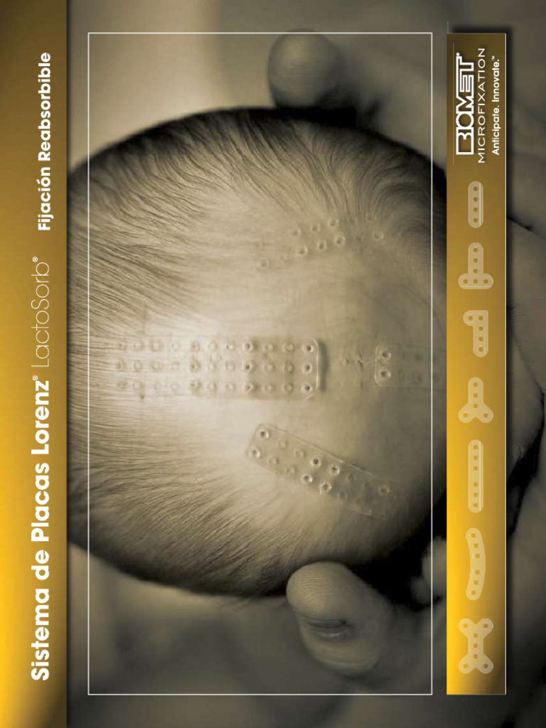 Microfixation 01 D12 | PDF