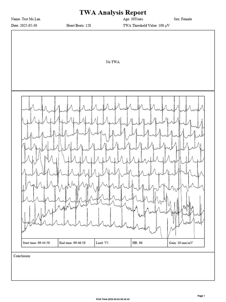 TWA Analysis Report for Ms. Lan | PDF