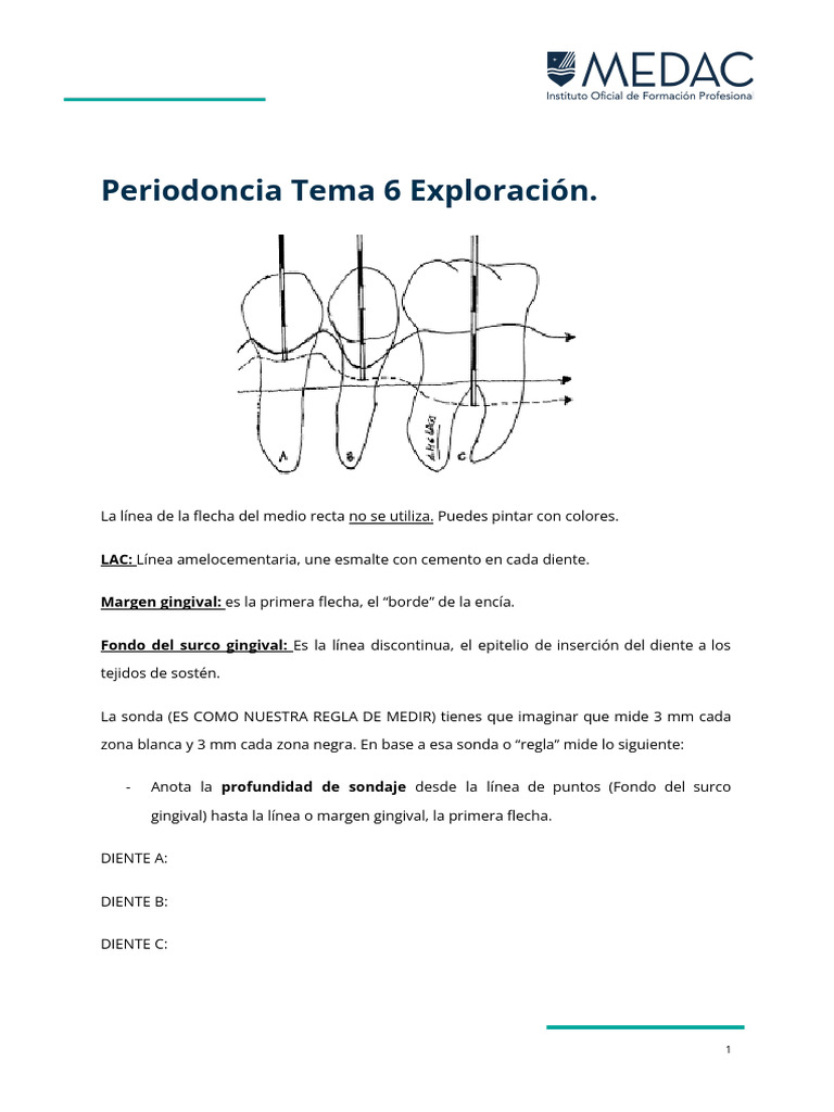 Actividad. Calcula Sondaje y Pérdida de Inserción | PDF
