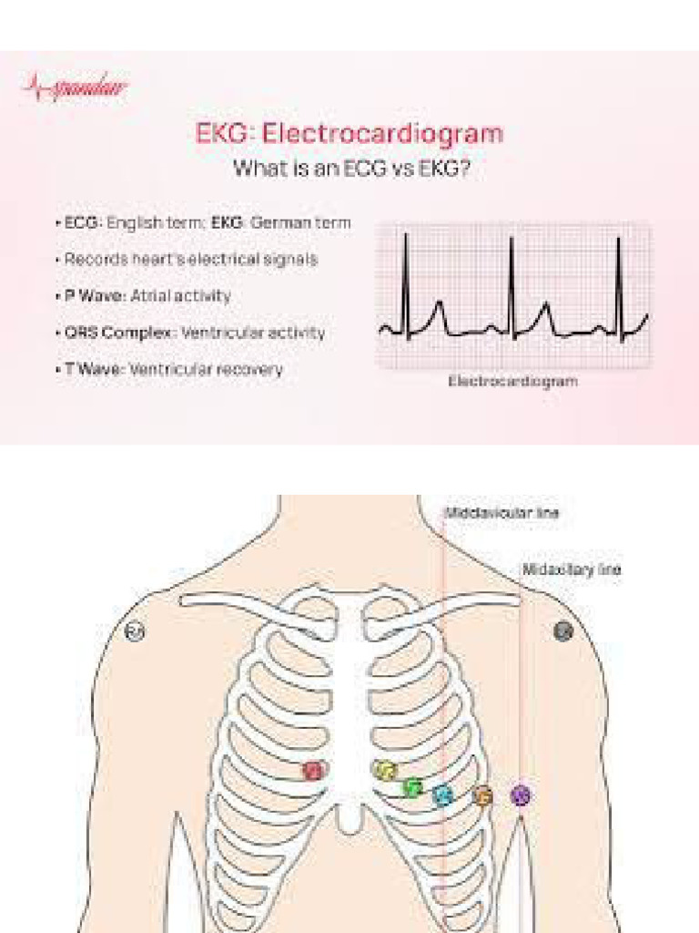Ecg | PDF