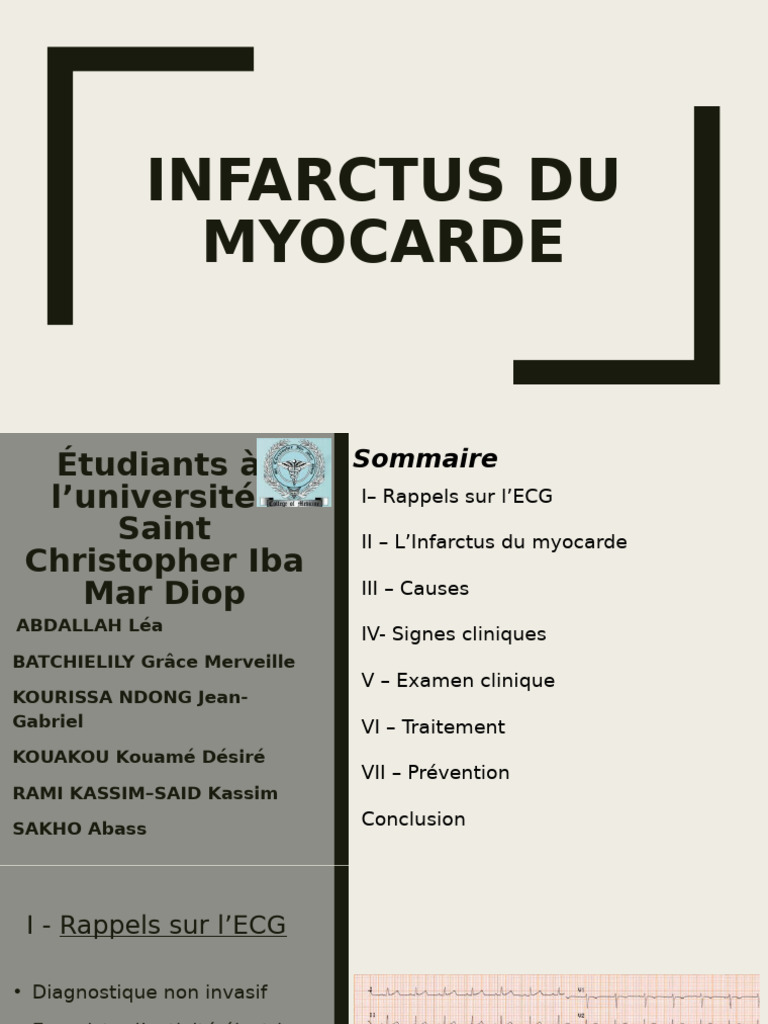 ECG et Infarctus du Myocarde | PDF | Infarctus du myocarde ...