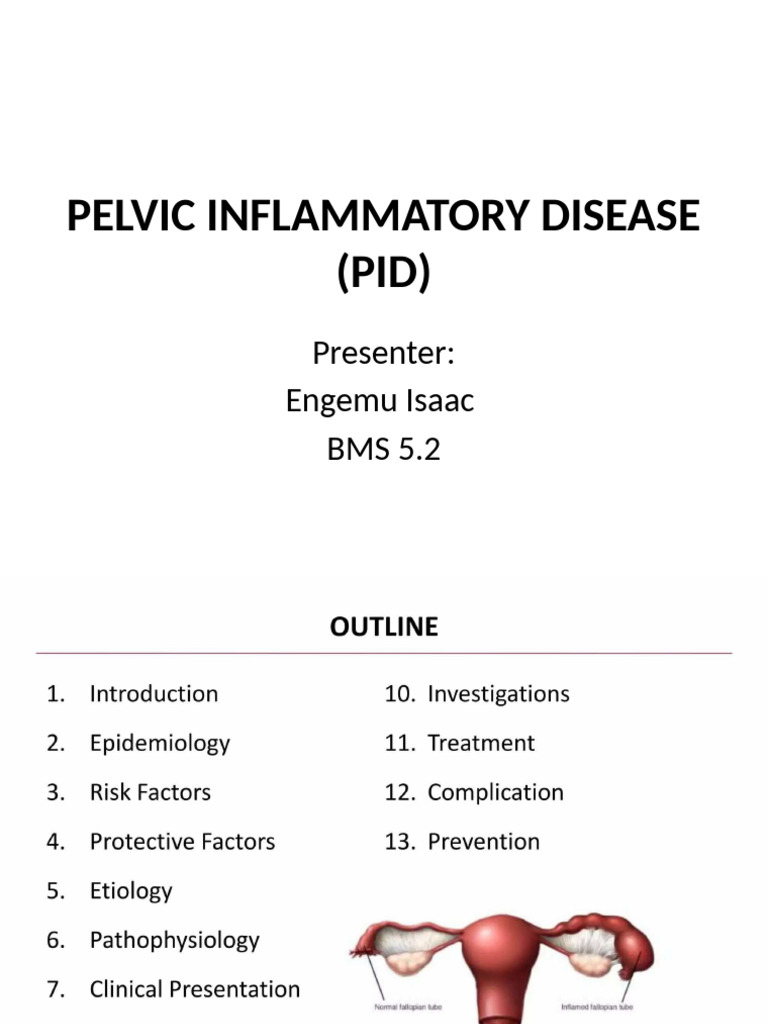 Tubo-Ovarian Abscess in PID Complications | PDF