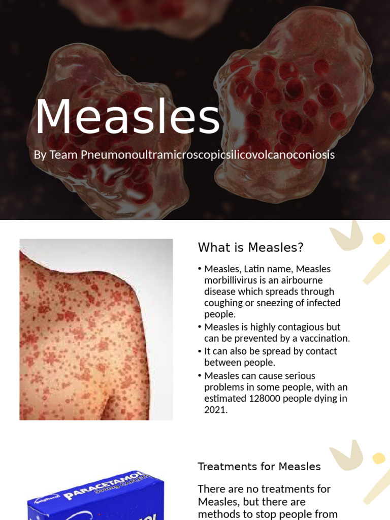 Understanding Measles: Symptoms & Prevention | PDF