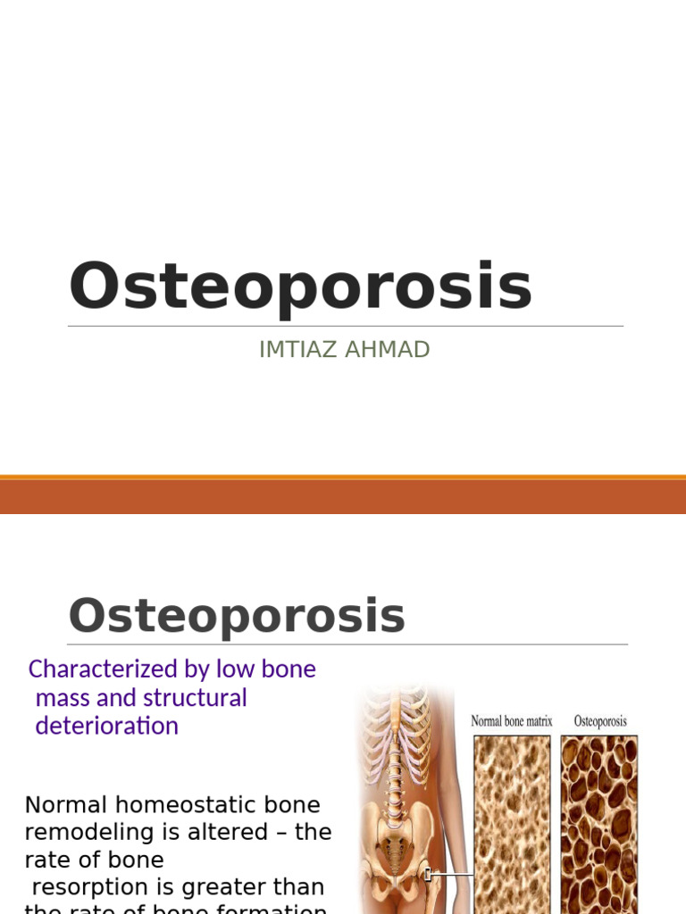 Understanding Osteoporosis and Its Risks | PDF | Osteoporosis | Wound