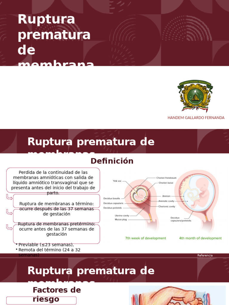 Ruptura Prematura de Membranas | PDF | Especialidades Medicas | Salud ...