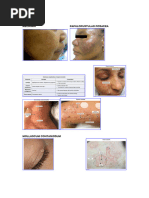 Diagnosis of Skin Conditions and ICD Codes | PDF | Dermatitis ...