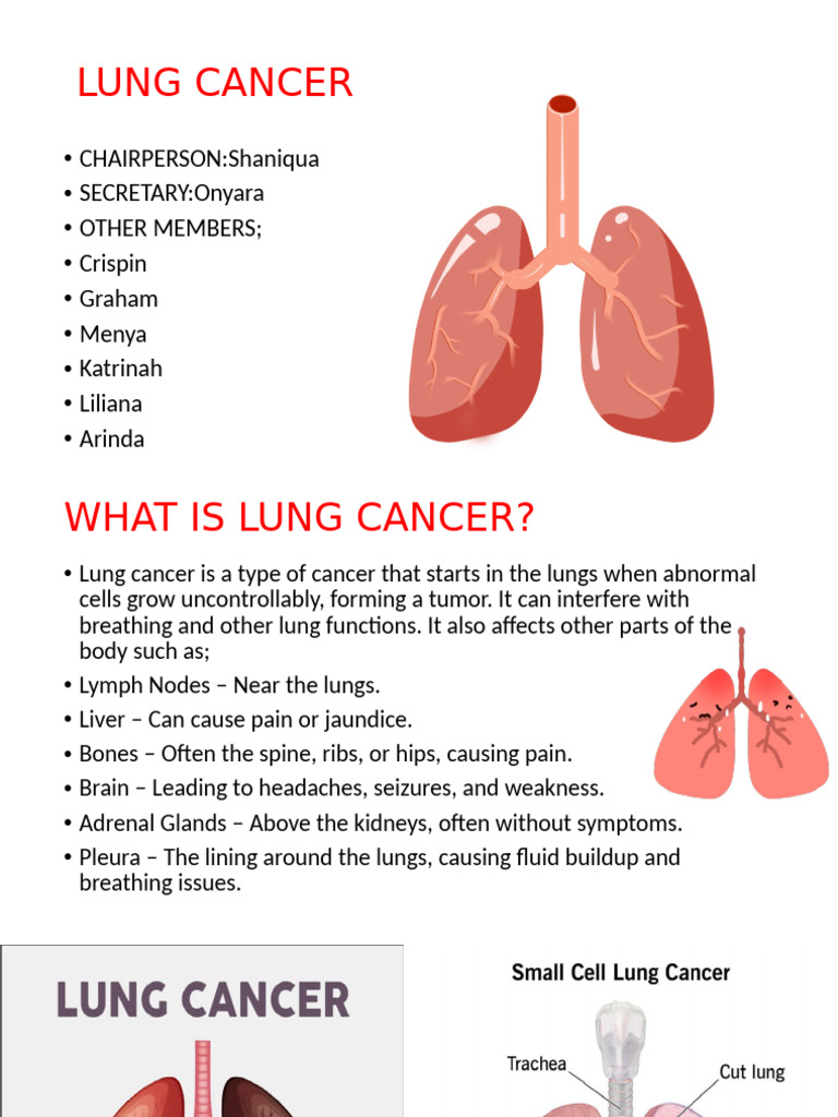 Understanding Lung Cancer: Causes & Effects | PDF | Lung Cancer | Cancer