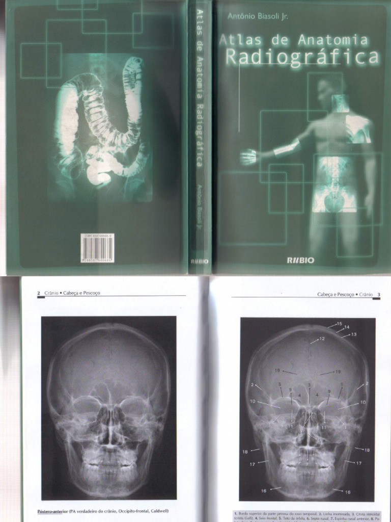 Atlas de Anatomia Radiográfica 2003 | PDF