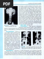 Signo Dandy HNP | PDF