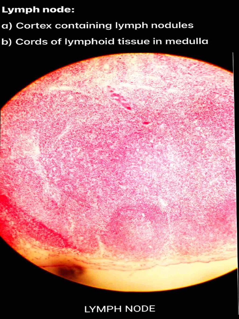 Lymph Node and Spleen | PDF