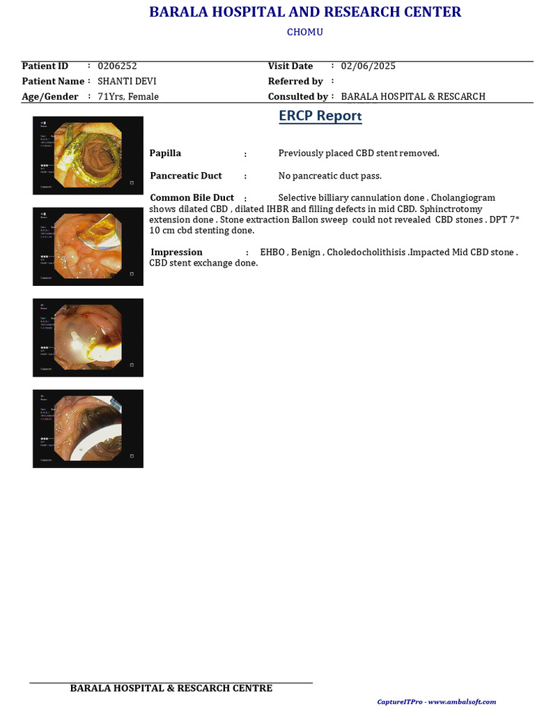 ERCP Report for Shanti Devi at Barala Hospital | PDF