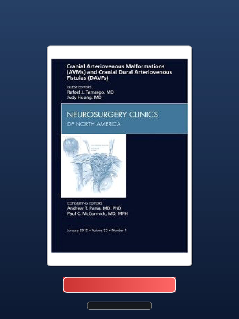 Cranial Arteriovenous Malformations and (Avms) Cranial Dural ...