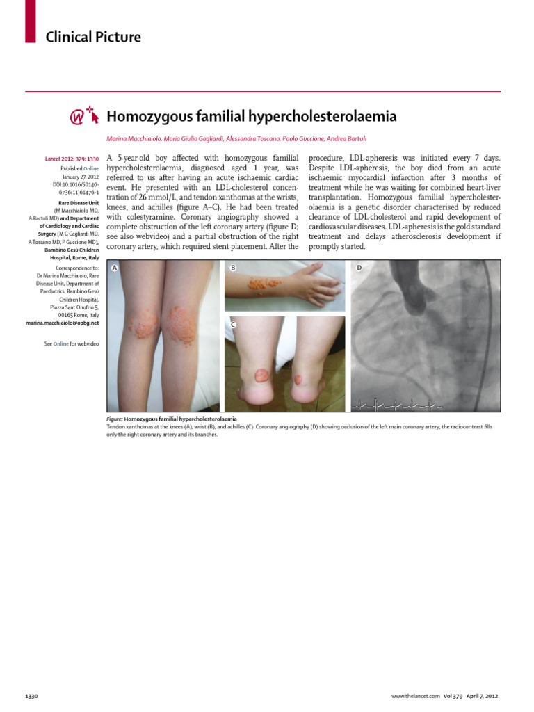 Homozygous Familial Hypercholesterolaemia | PDF