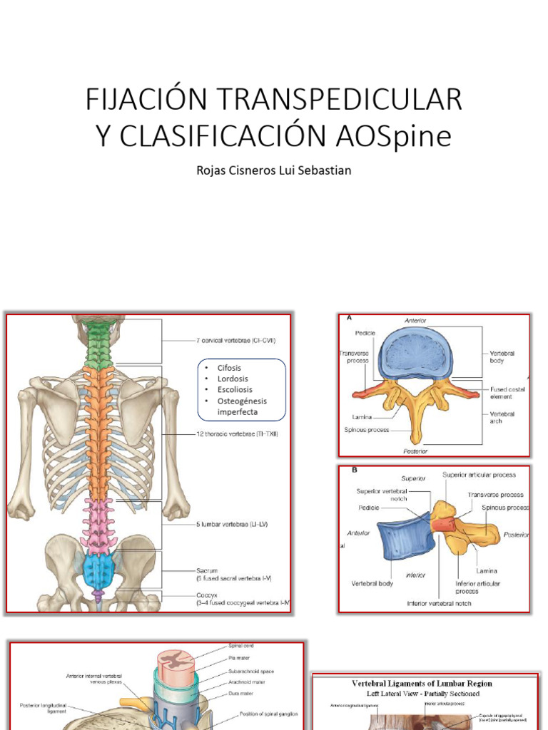 Fijación Transpedicular y Clasificación AOSpine | PDF | La columna ...
