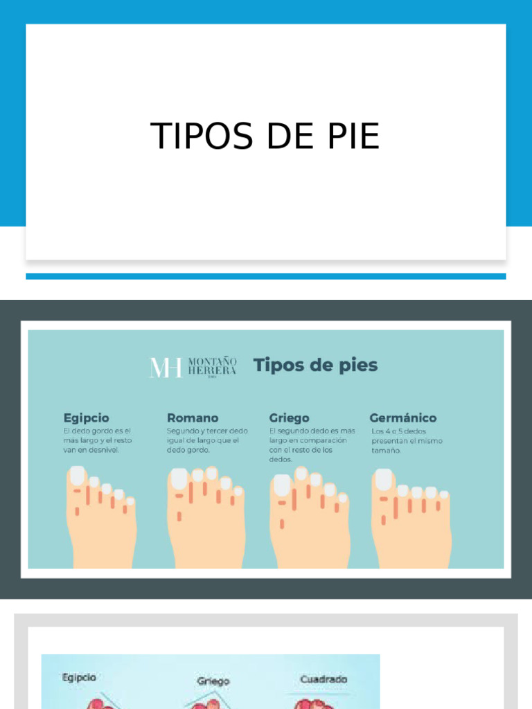 Tipos de Pie | PDF