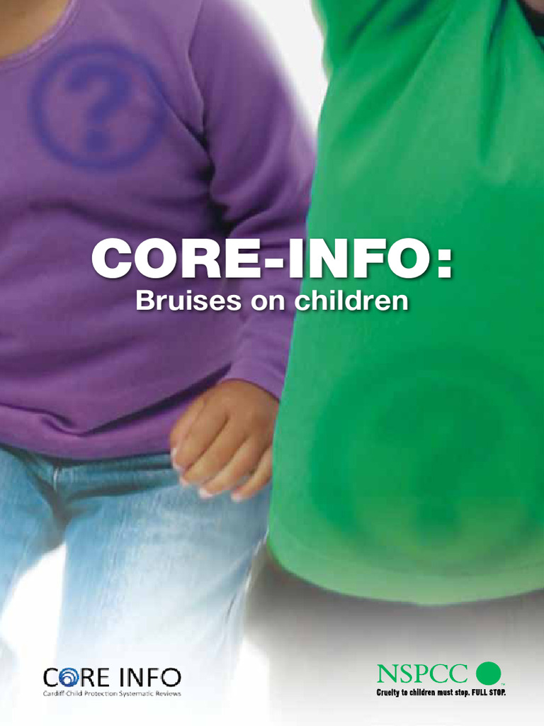 Core Info Bruises Children | PDF | Diseases And Disorders