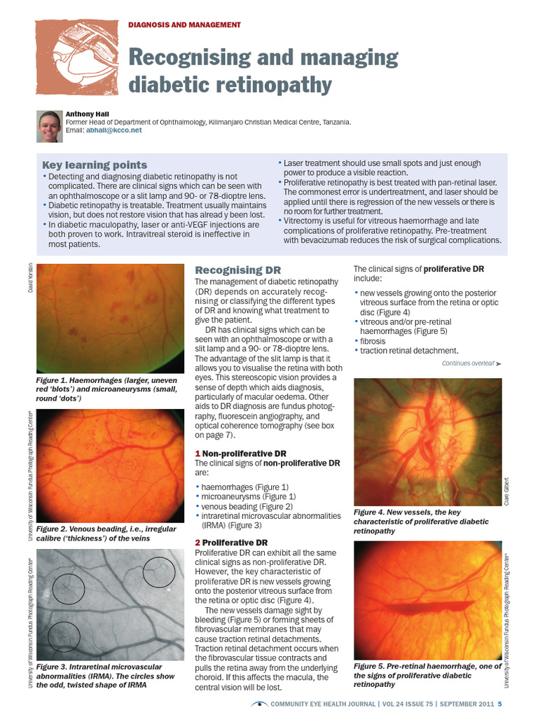 Managing Diabetic Retinopathy Guide | PDF | Retina | Medical Specialties