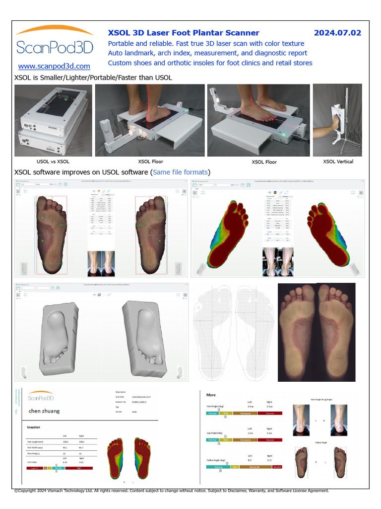 XSOL 3D Laser Foot Scanner Overview | PDF | Image Scanner | Foot