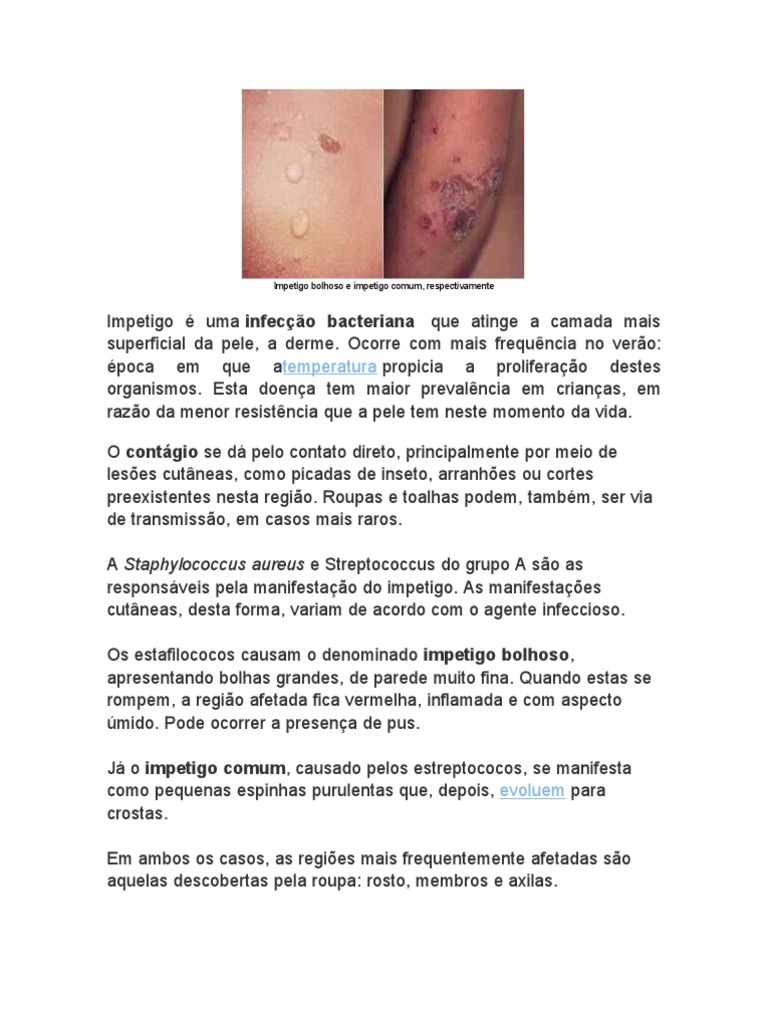 Impetigo Bolhoso e Impetigo Comum