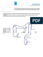 Medical Comprendre La Diverticulose