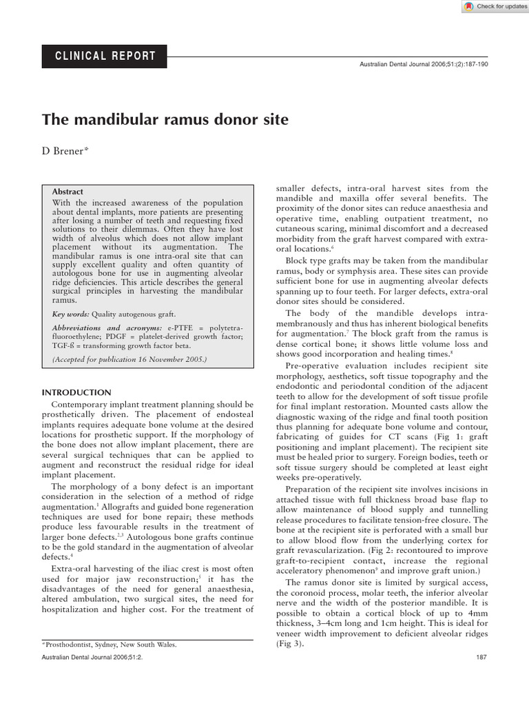 Harvesting Bone from Mandibular Ramus | PDF | Dental Implant | Medical ...