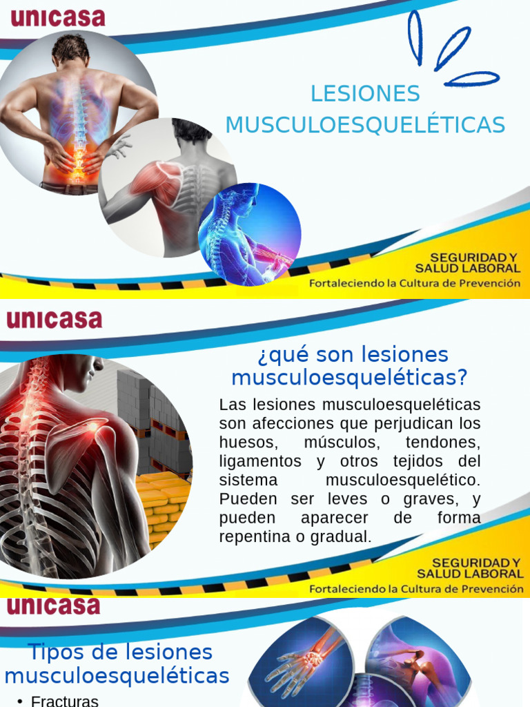 Lesiones Musculoesqueleticas | PDF