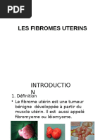 Classification FIGO Des Fibromes Utérins - Embolisation Fibrome Utérin ...