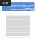 ECG Changes in Hypokalaemia | PDF | Nutrition | Diet & Nutrition