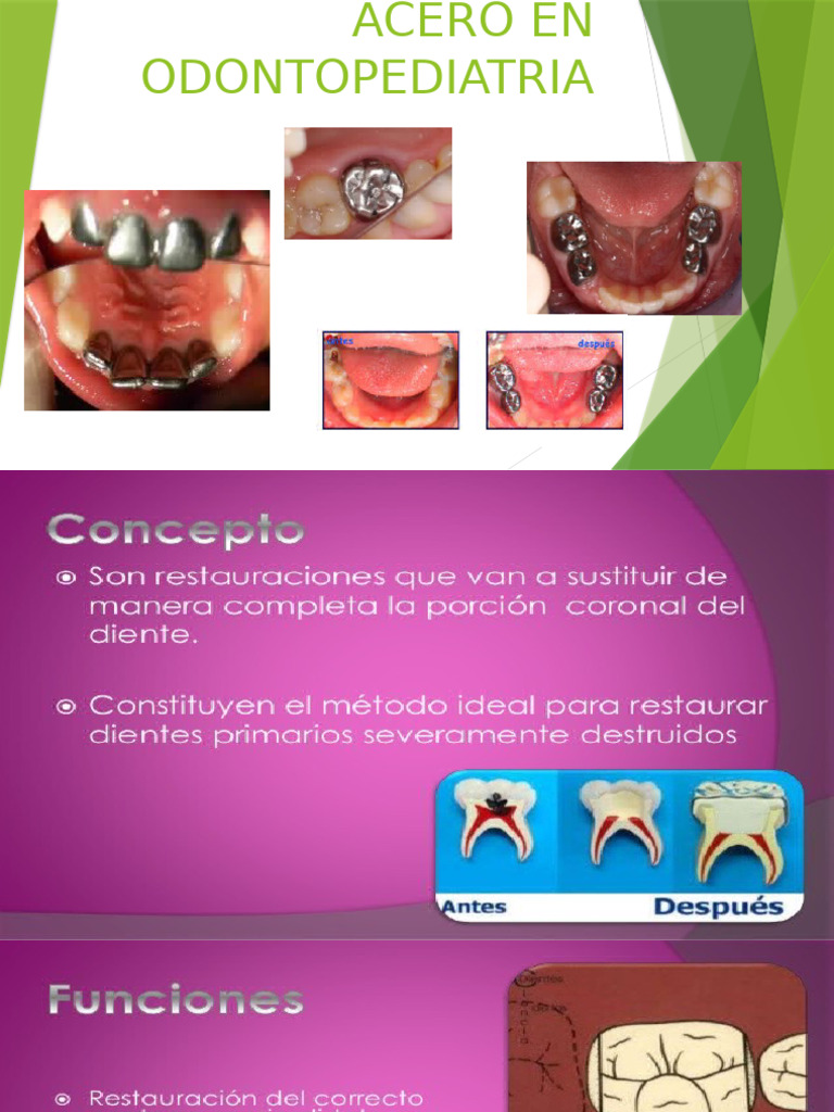 Coronas de Acero | PDF