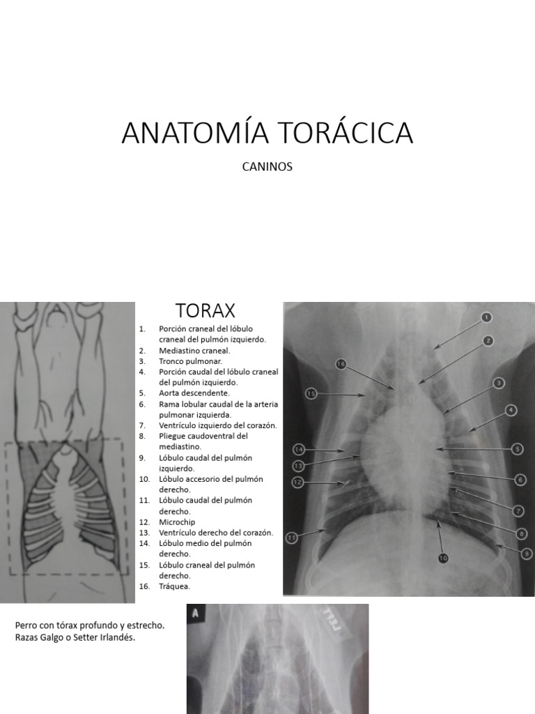 Torax RX | PDF