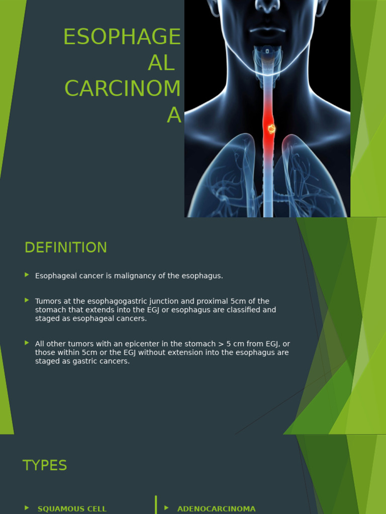 Esophageal Carcinoma | PDF | Esophagus | Esophageal Cancer