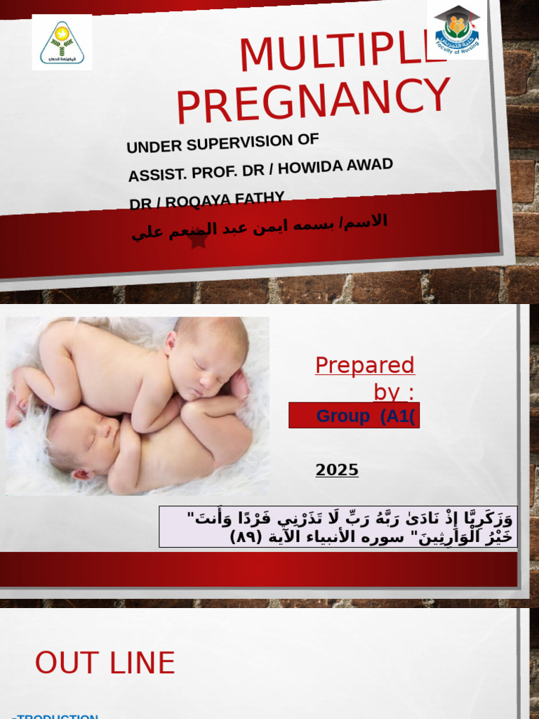 Understanding Multiple Pregnancy Risks | PDF | Multiple Births | Childbirth