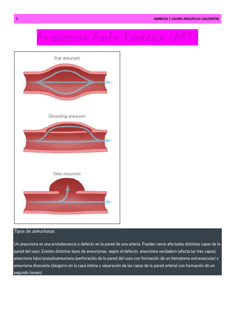 Aneurisma de Aorta Torácica: Tipos y Diagnóstico | PDF | Aorta | Tórax