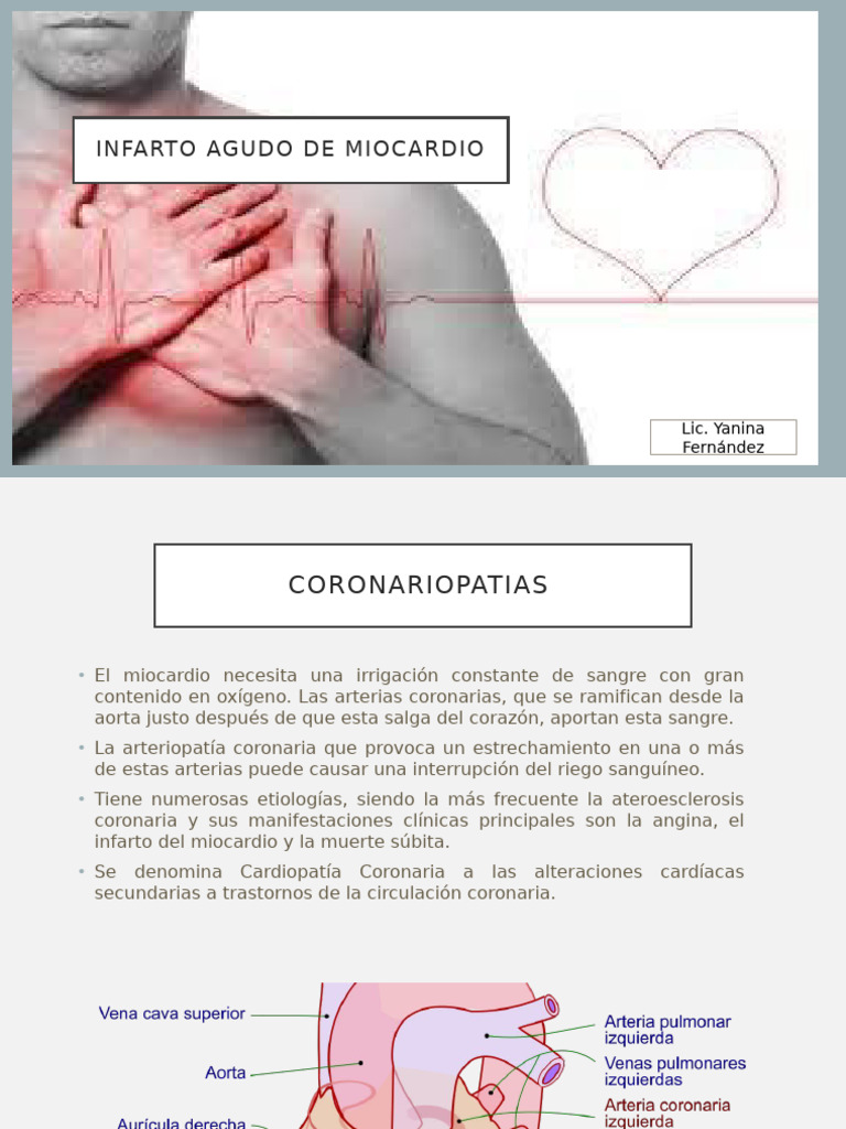 Angina e IAM | PDF | Infarto de miocardio | Isquemia