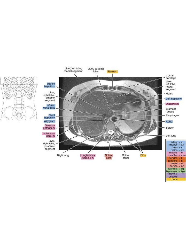 Magnetic resonance imaging visual data 7