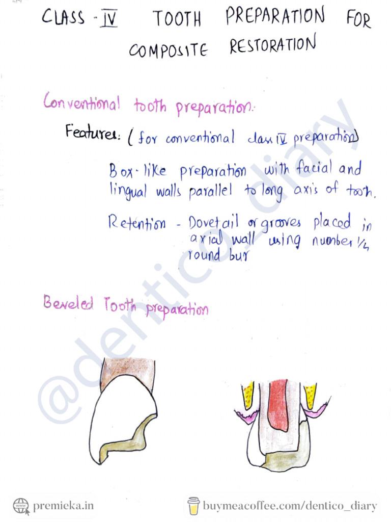 Class - IV Tooth Preparation For Composite Restoration | PDF