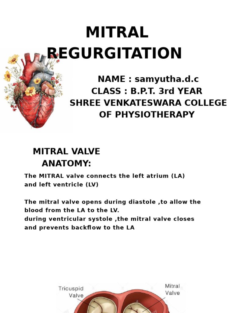 Understanding Mitral Regurgitation Causes | PDF | Heart Valve | Heart
